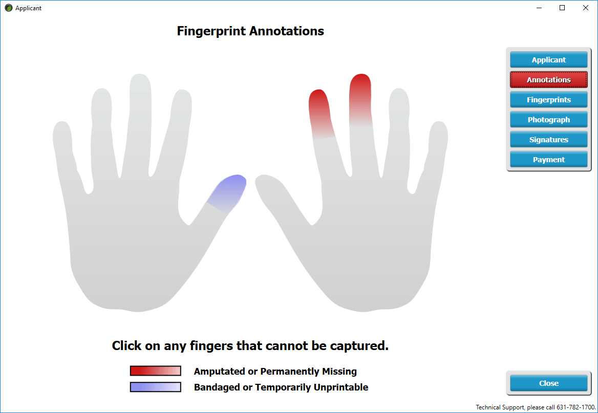 Amputations fingerprinting